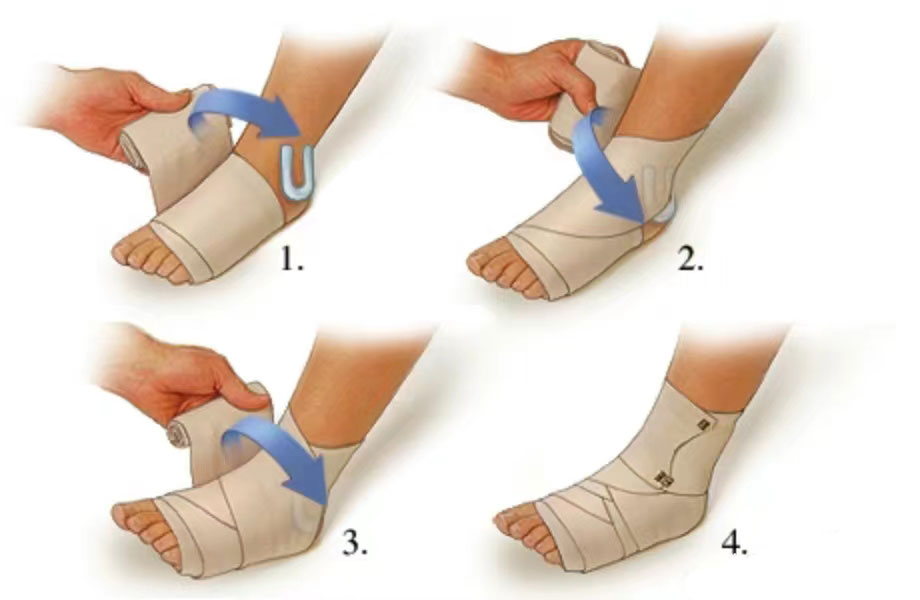 Guide de premiers soins pour les blessures au pied